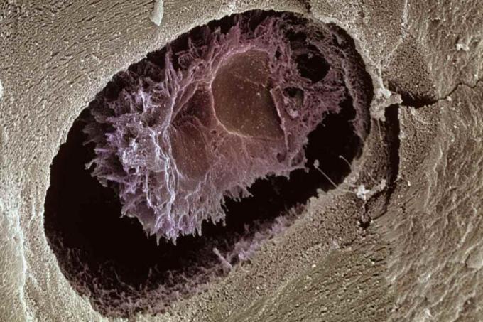 Osteocyt: Bone Cell